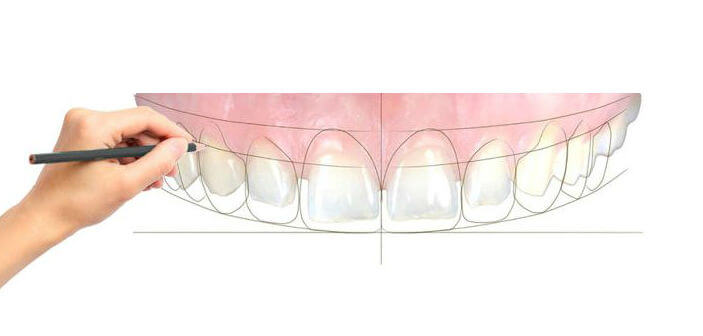 Thiết Kế Nụ Cười